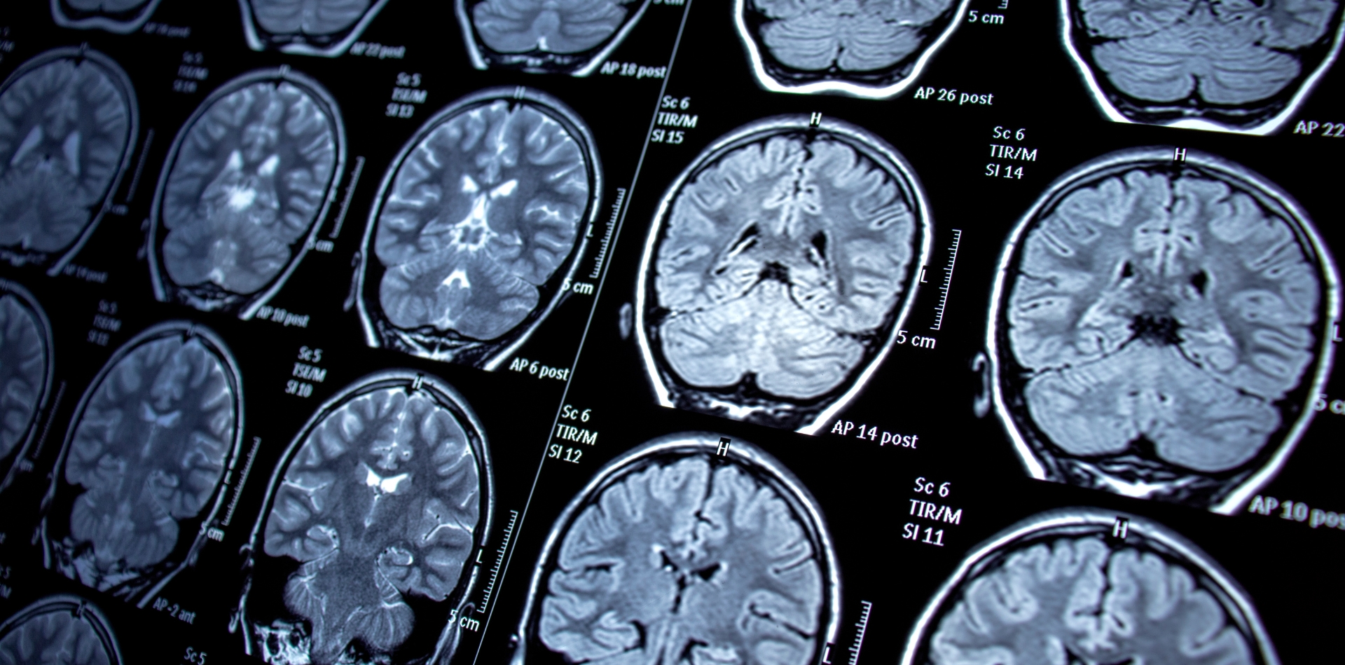 Consulenza forense neurochirurgica a Reggio Calabria